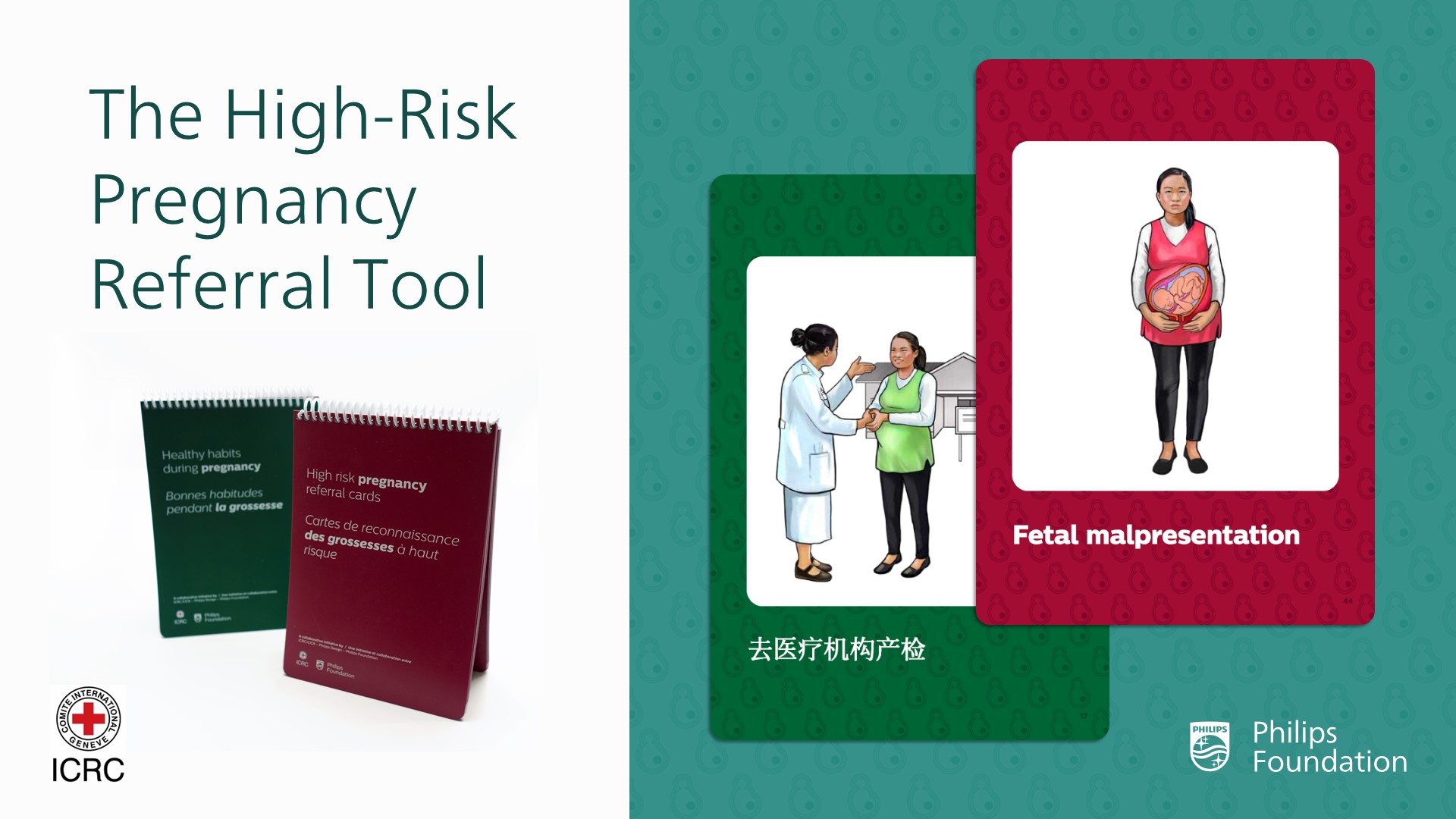 Stroke care study Nigeria